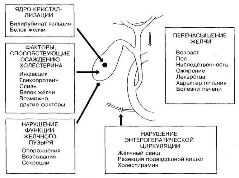 Лямблиоз