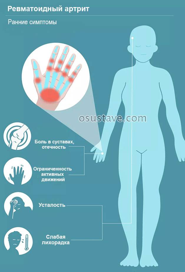 Ювенильный ревматоидный артрит: симптомы, методы лечения