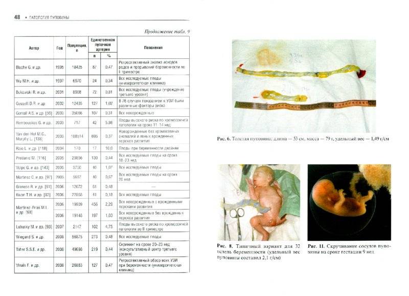 Кардиотокография (ктг). исследование и запись сердцебиения ребенка