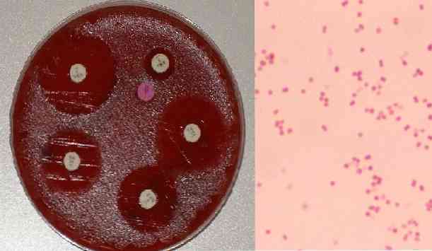 Антибиотики при стоматите : инструкция по применению | компетентно о здоровье на ilive