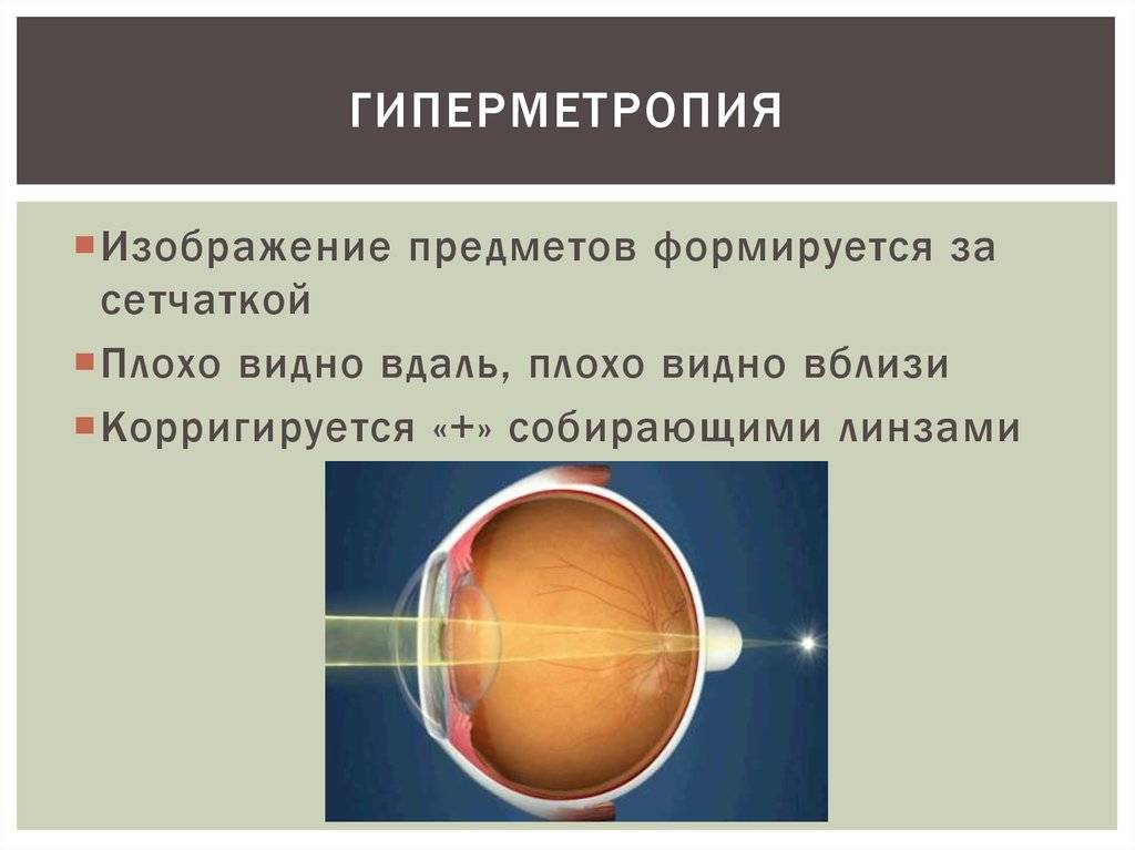 Глазные болезни у детей: астигматизм - энциклопедия ochkov.net