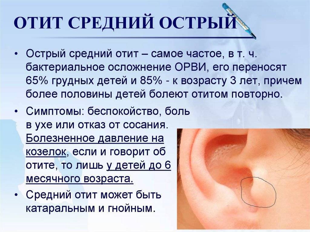Острый отит, фото, причины и лечение острого отита среднего уха без температуры, причины и последствия боли