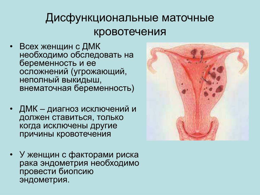 Лечение эндометриоза у женщин после 40-50 лет во время менопаузы
