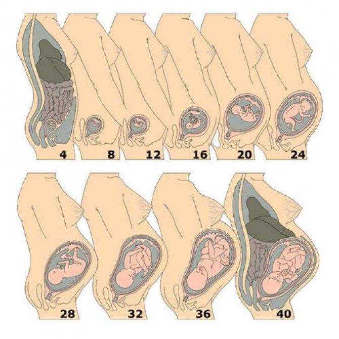 Как изменяется матка на ранних сроках беременности?