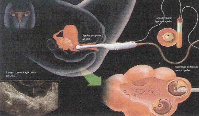 Имплантация эмбриона после эко. признаки и правила поведения