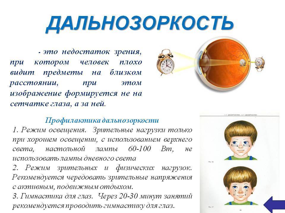 Сильная близорукость у ребенка - энциклопедия ochkov.net