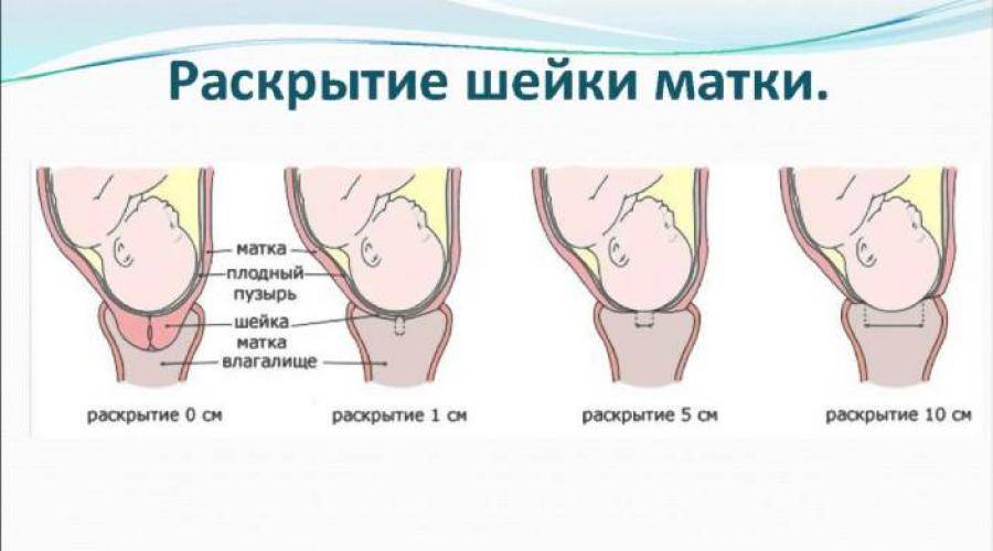 Как перед родами ускорить раскрытие шейки матки в домашних условиях: «мужетерапия» и специальные упражнения