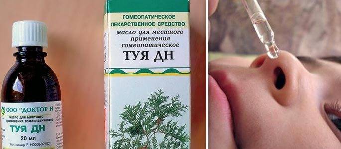 Эндоскопическое удаление аденоидов