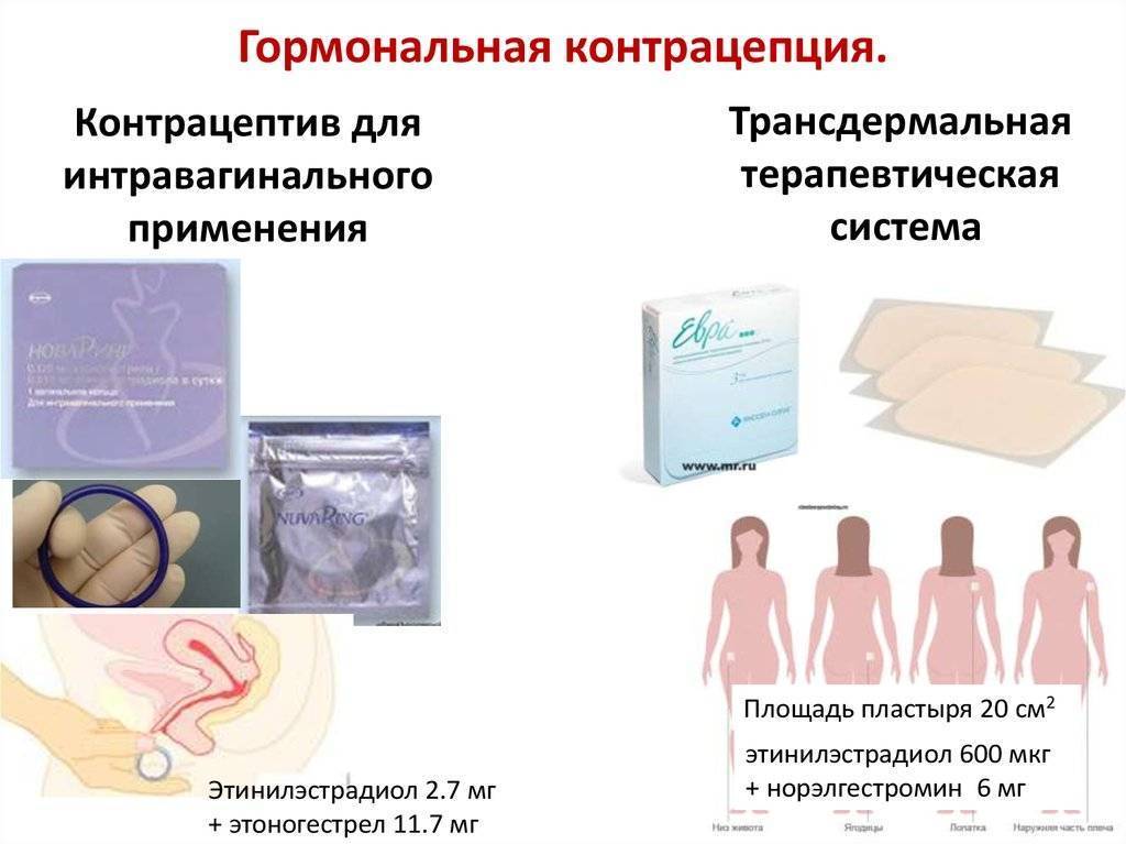 Контрацепция: правила подбора, эффективность и противопоказания | университетская клиника
