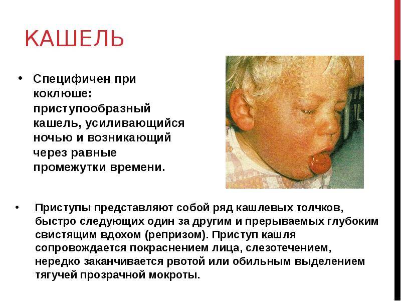 Приступообразный кашель у ребенка (сухой или влажный) в ночное время: что делать и как помочь?