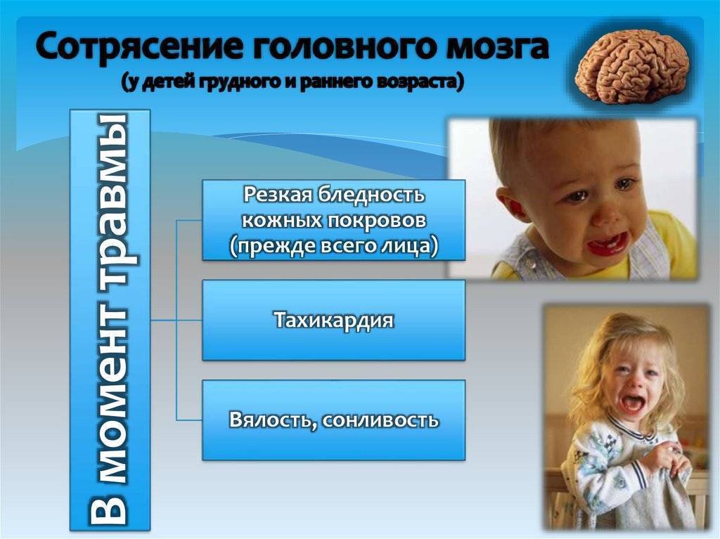 Сотрясение головного мозга у детей
