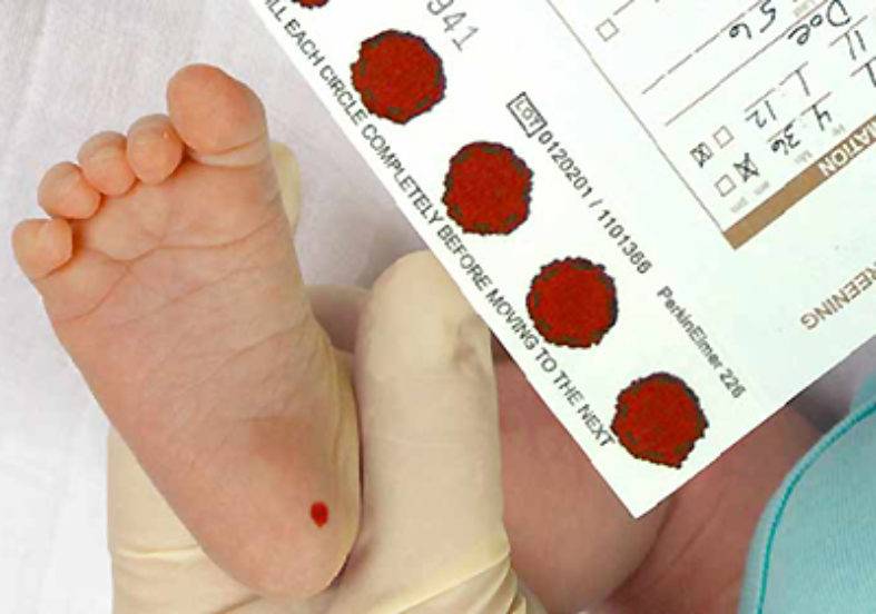 Сохранение пуповинной крови: зачем и как - причины, диагностика и лечение