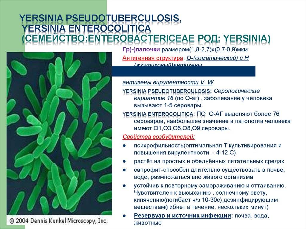 Антитела к возбудителям псевдотуберкулеза, yersinia pseudotuberculosis рнга (титр)