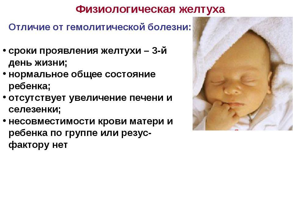 Желтуха новорожденных: виды, причины, особенности развития