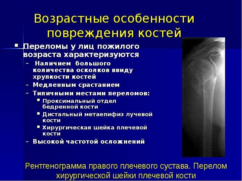 Что такое перелом? типы и признаки перелома.
