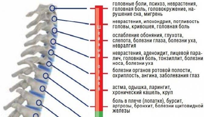 Остеохондроз при беременности: каковы симптомы и чем лечить патологию разных отделов позвоночника?