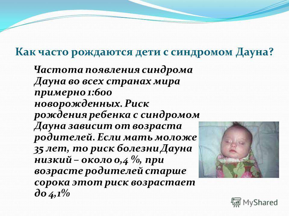 Синдром дауна: признаки, причины, диагностика — online-diagnos.ru