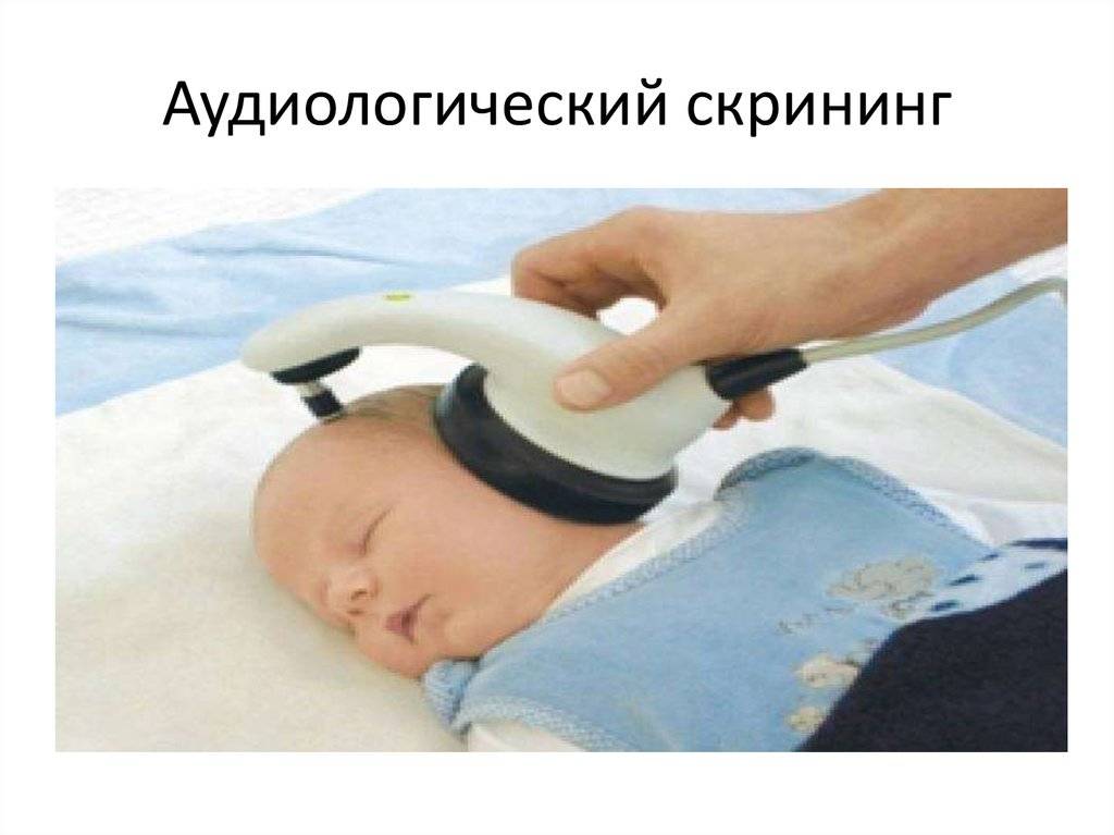 Как сделать так, чтобы ребенок заснул для исследования слуха (ксвп)?