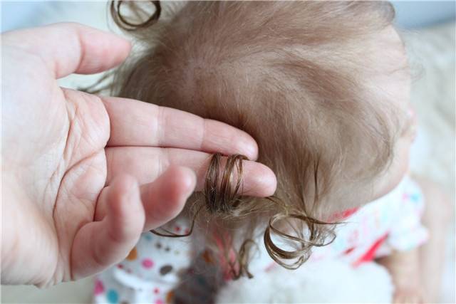 ᐈ выпадение волос у детей: причины и методы лечения