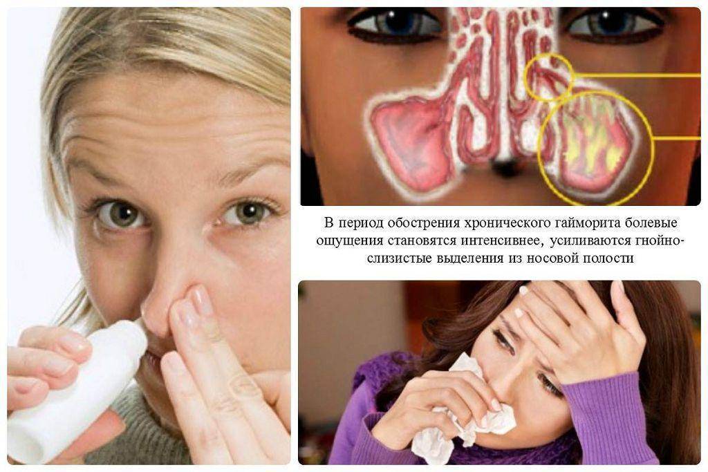 Хроническая заложенность носа: когда нужен врач, причины и лечение