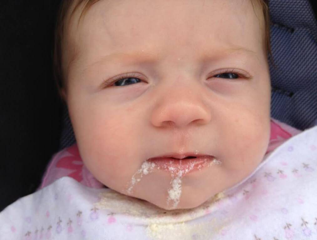 Почему ребенок срыгивает грудное молоко