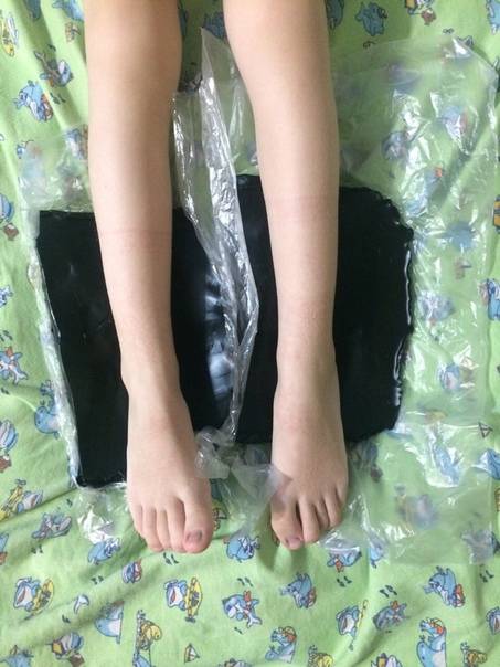 Парафинотерапия для ног: выполнение в салоне и дома