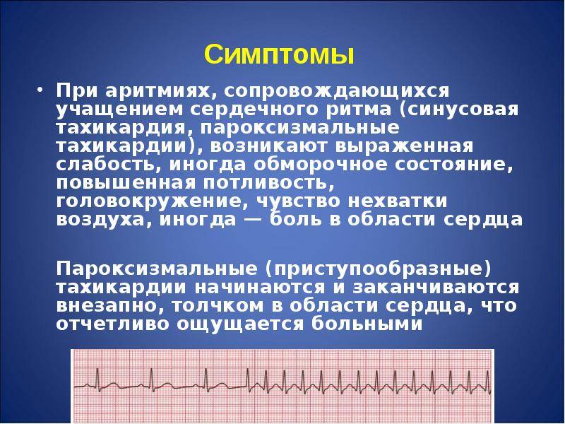 Аритмия сердца: симптомы, лечение