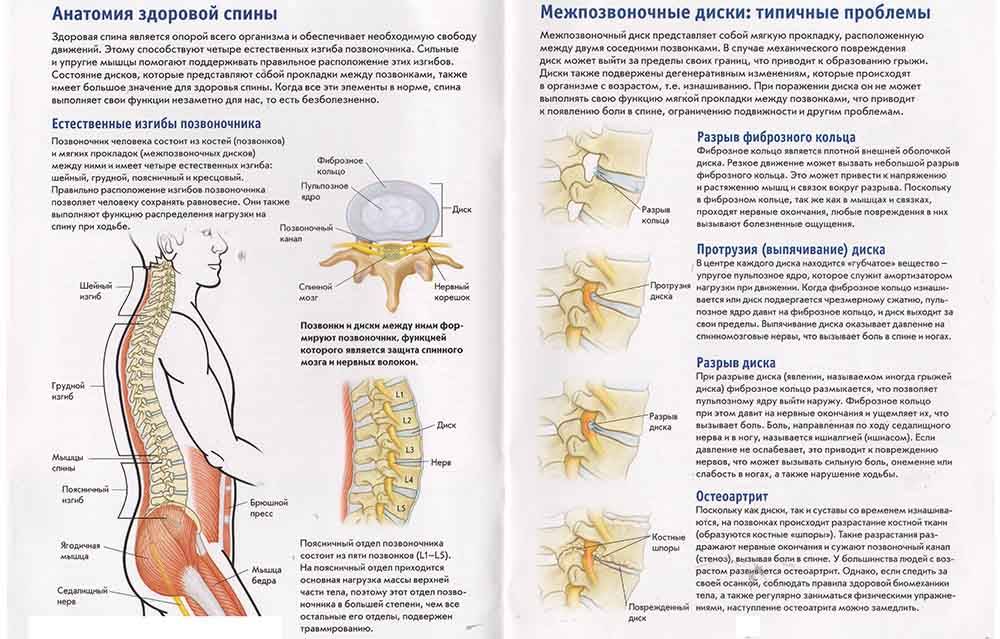 Грудной остеохондроз 2 степени