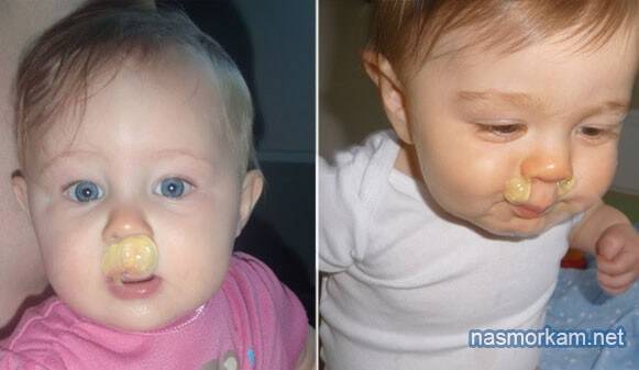 Желтые сопли у ребенка до года — почему появляется слизь в носу