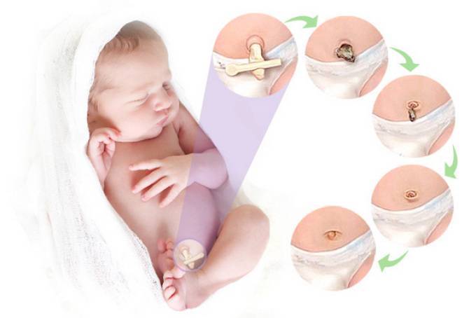 Хлорофиллипт для новорожденных для пупка: правила обработки ранки