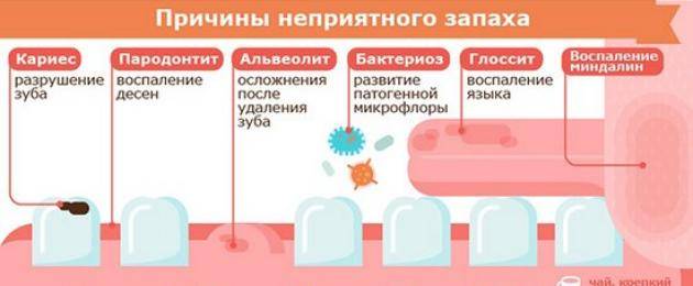 Неприятный запах изо рта: в чем причины проблемы и как от нее избавиться?