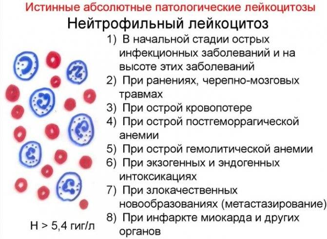 Лейкоциты в крови