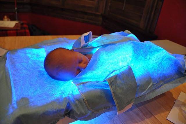 Лечение желтушки у новорожденных: фототерапия, лампа, капельницы. как давать глюкозу?