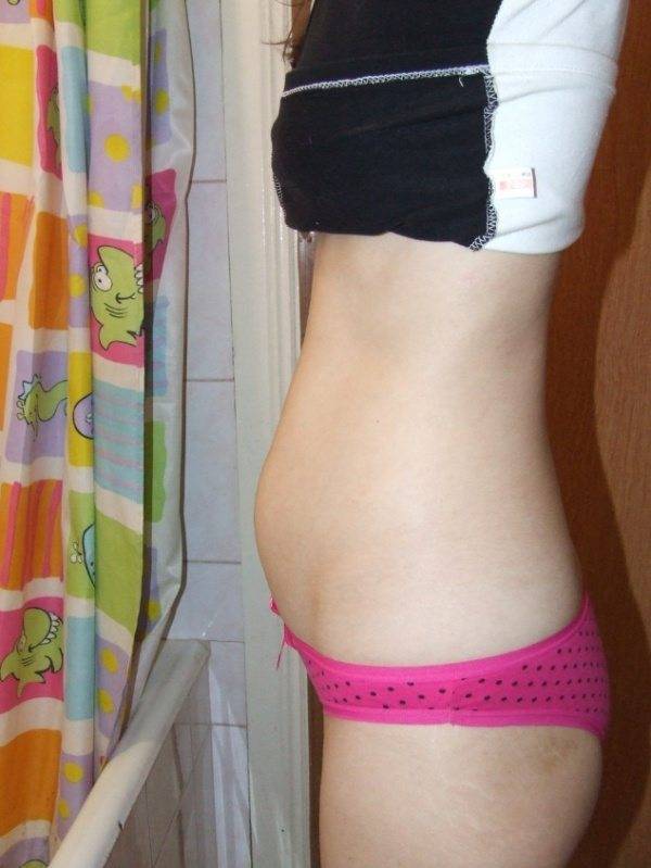 8 месяц беременности: что происходит с малышом и мамой, фото живота, сколько недель — медицинский женский центр в москве