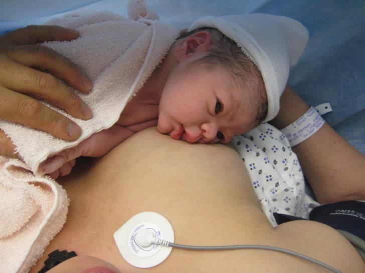 Кесарево сечение: 5 вопросов о родах, операции и ребенке. сколько детей можно родить после кесарева