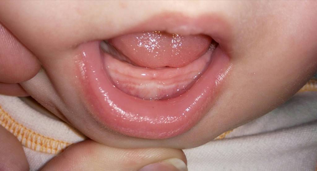 Порядок прорезывания зубов у детей, сроки прорезывания молочных зубов | colgate