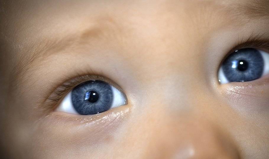 Тёмные круги и синяки под глазами - причины возникновения и методы коррекции.
