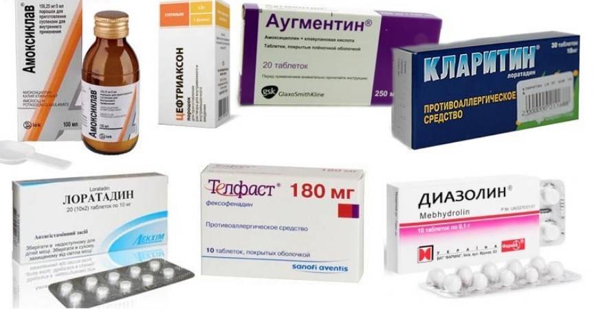 Аллергия на антибиотики: что делать