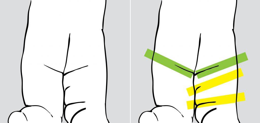 Несимметричные складки на ножках у грудничка