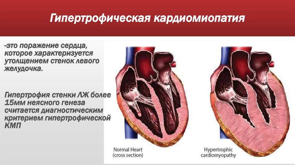 Ибс (ишемическая болезнь сердца) - недостаточность кровоснабжения сердца.: причины, жалобы, диагностика и методы лечения на сайте клиники «альфа-центр здоровья»