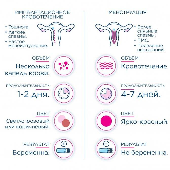 Как отличить имплантационное кровотечение  от менструации