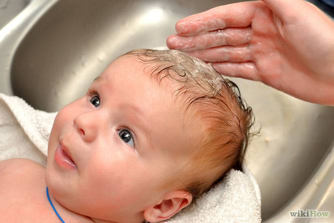 Выпадение волос у новорожденных и грудных детей