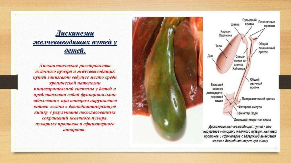 Дискинезия кишечника