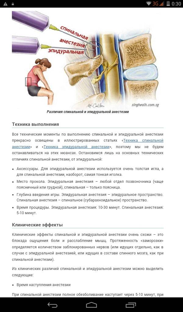 Спинальная и эпидуральная анестезия: различия | vnarkoze.ru