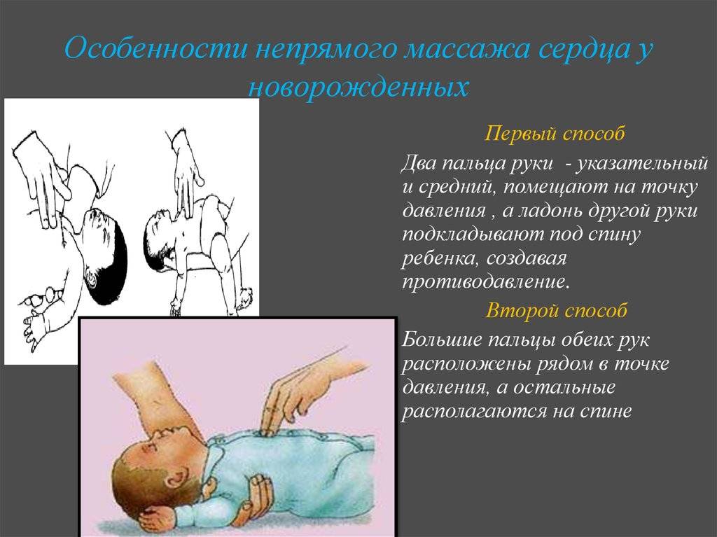 Первая помощь детям: реанимация – напоправку