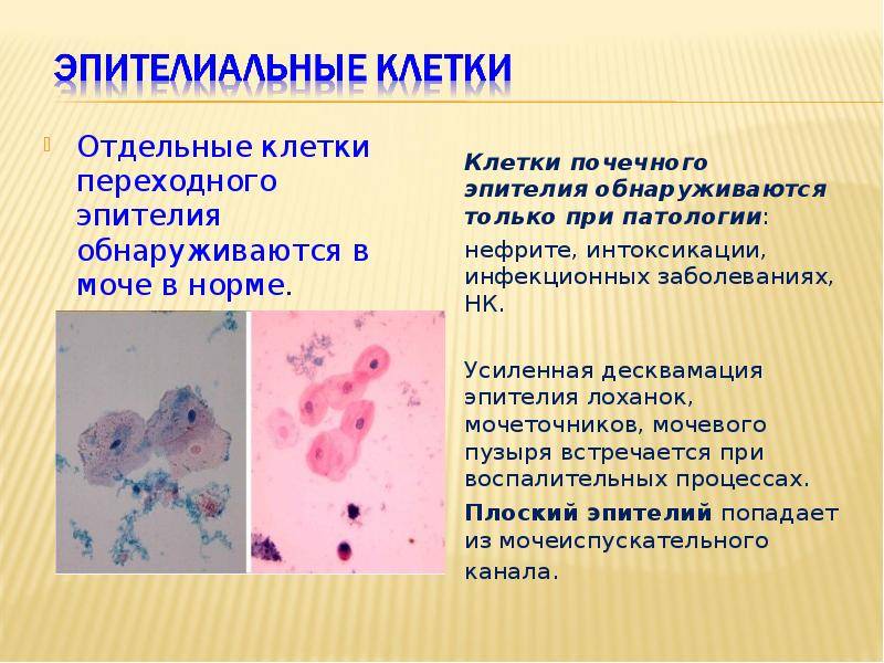Эпителий (плоский, переходный, почечный) в моче у ребенка (грудничка, подростка): норма, повышенный, анализы, причины отклонений, лечение | narod-metod.ru