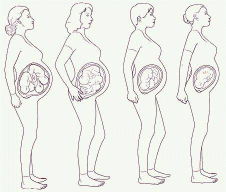 Расположение плода при беременности