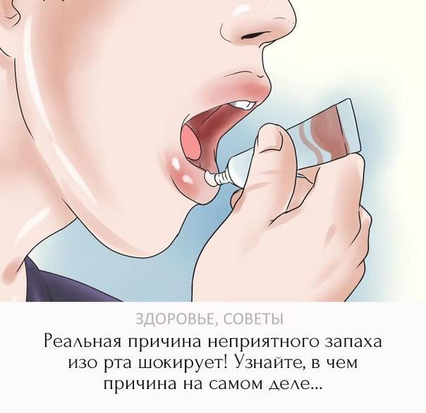 Как плохой запах изо рта связан с гайморитом? | лор боклин а. к.