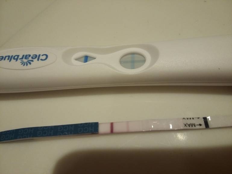 3 день после переноса эмбрионов