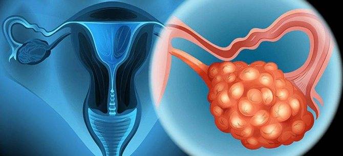 Подготовка эндометрия к эко - статья репродуктивного центра «за рождение»